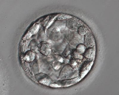 εμβρυομεταφορά βλαστοκύστης