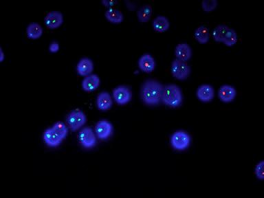процента анеуплоидии в сперме