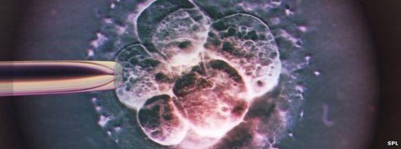 image embryo transpl