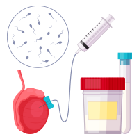 Egg and Sperm Preparation