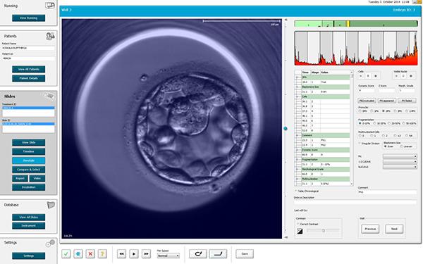 Εμβρυοσκόπηση