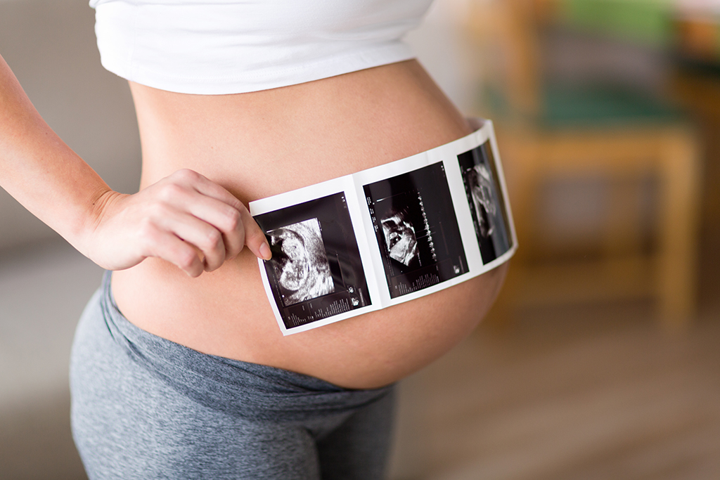 pregnant woman holding ultrasound photo on belly MCB5DUG